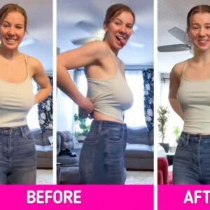 From Pain to Freedom: The Jaw-Dropping Transformation of Janel Nelson's Breast Reduction Journey